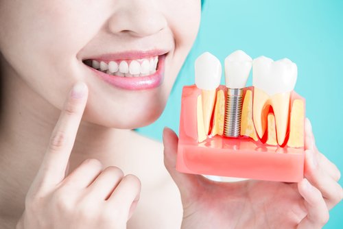 implanty zębów warszawa wola